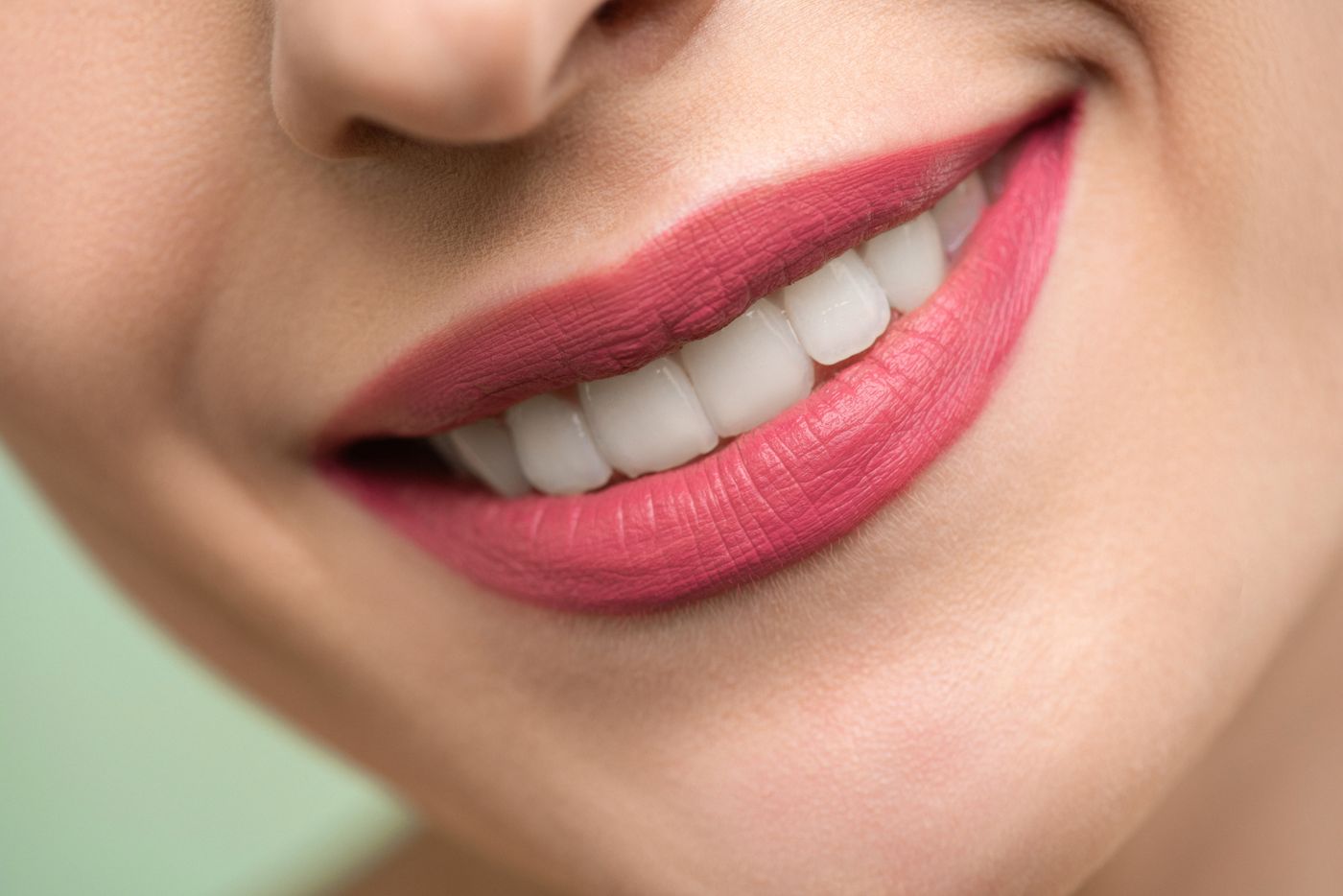 Blanqueamiento dental profesional